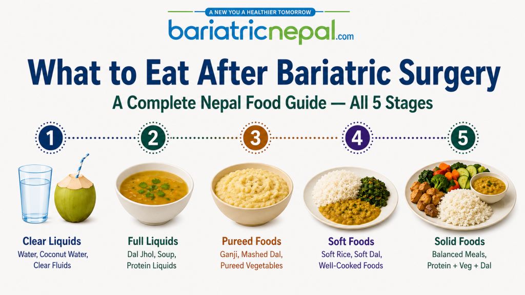Infographic showing 5 stages of food progression after bariatric surgery for Nepal patients
